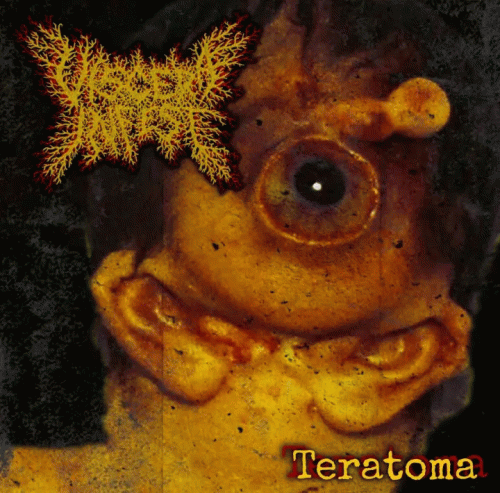 Viscera Infest : Teratoma